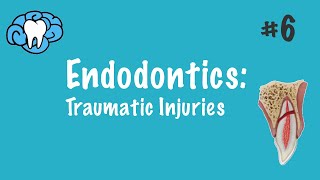 Endodontics  Traumatic Injuries  INBDE ADAT [upl. by Haduhey539]