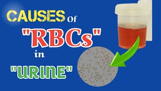 Causes of RBCs in Urine  Clinical Importance Hematuria Symptoms False hematuria  Animated [upl. by Swane]