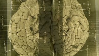 Images of Einsteins brain revealed [upl. by Coumas74]