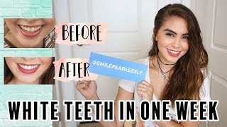 How I Got White Teeth in ONE WEEK  Smile Brilliant Review amp Tutorial  Jessica Neistadt ♡ [upl. by Vatsug]