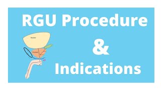 RGU procedure amp its indication [upl. by Anitsyrk]