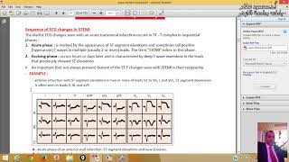 17 Ischemic Heart Diseases ProfDrmahmoud Allam [upl. by Hibbert]