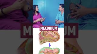 क्या epidural की वजह से cesarean होता है  Dr Sonal Pariharsonaamedihub sonaamedihubhospital [upl. by Martreb]