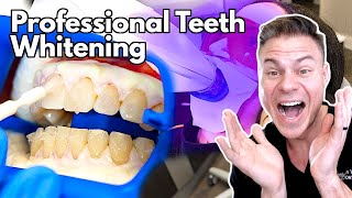 How Teeth Whitening At The Dentist WorksAnd Is It Worth It Orthodontist Reacts [upl. by Ahseined]