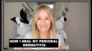 PERIORAL DERMATITIS  HOW I TREAT MY SKIN FLARE UPS [upl. by Suoivatnod507]