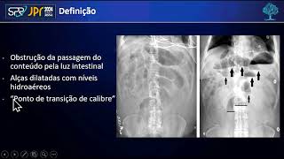 Videoteca Top 5 de Outubro2024  Obstrução Intestinal Roteiro de Avaliação [upl. by Onil812]