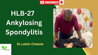 HLB27 Ankylosis Spondylitis  Treatment By Girivardhan Herbs Bone Setting [upl. by Eneirda]