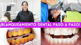 ¡ASÍ SE HACE UN BLANQUEAMIENTO DENTAL  TE MUESTRO EL PASO A PASO 🦷✅ blanqueamientodental [upl. by Casi803]