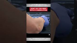 Dont Go Too Deep with IV Cannulation  shorts ivcannulation anesthesiology nurse [upl. by Sheri859]