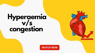 Hyperaemia vs congestion  pathology  MBBS [upl. by Kuster]