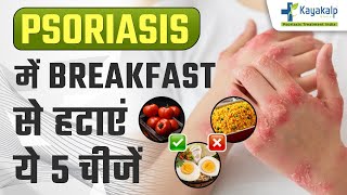 Psoriasis में इन 5 चीज़ो भूल कर भी ना खाये  Dont Eat These 5 Foods in Psoriasis  Kayakalp Global [upl. by Prochoras519]