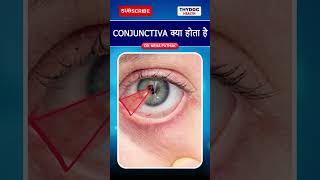 Conjunctiva क्या होता है conjuctivitis conjuctivitisintheeye conjuctivitistreatment thydochealth [upl. by Naginnarb]