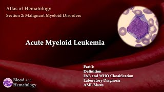 Acute Myeloid Leukemia AML  Part 1 [upl. by Ardnasac]