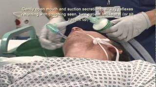 Intubation Extubation 67 [upl. by Iolande966]