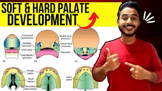 development of palate embryology  soft palate development embryology [upl. by Ahsien]