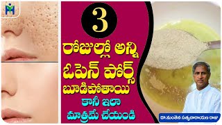 Top 5 Home Remedies For OPEN PORES  స్కిన్ పై గుంతలకు చెక్   Dr Manthena Satyanarayana Raju [upl. by Claudio634]