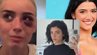 dixiedamelio Beaten up By Her sister Charlie Damelio full video [upl. by Lenoyl]