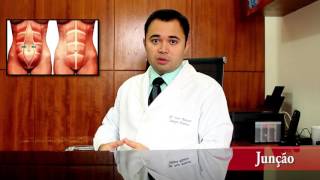 Abdominoplastia com Lipoaspiração [upl. by Luckett]