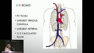 ECMO Cannulation Methods Per Diagnosis [upl. by Metah]