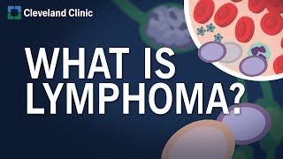 What Is Lymphoma [upl. by Rena810]