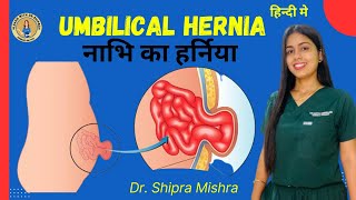 Umbilical hernia symptoms and treatment  Umbilical hernia surgery  Dr Shipra  hernia [upl. by Maximilianus]