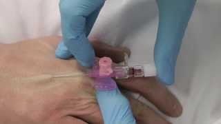 Cannulation How to insert a cannula One Minute Edition Medicine in a Nutshell IV Access [upl. by Narcho]