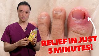 6 HOME REMEDIES To Treat A PAINFUL Ingrown Nail  Dr Kim [upl. by Wagstaff]