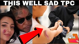 Gunmen ROb Vybz kartel And Sidem All The Car Dem Take Away  Woman Speak About The RObb3ry [upl. by Kilah]