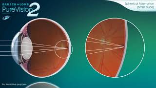 PureVision 2 HD Contact Lenses [upl. by Durr]