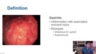 Gastritis vs Gastropathy [upl. by Ilime]