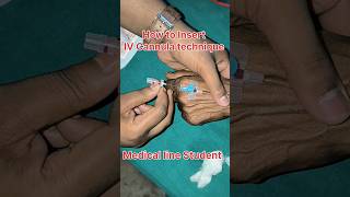 IV Cannula technique IV Cannula कैसे लगाते हैं medical nursingh bscnurcing cannula vigo bams [upl. by Atinoj]