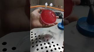 How To Streak For Blood Agar Plates Bacterial Streaking Technique [upl. by Angelica]