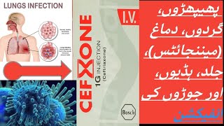 CEFXONE  CEFTRIAXONE cefxone 1g injection [upl. by Artair949]