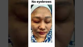 VJ Thapa Raghu Permanent Eyebrows  Dr Aesthetix Cosmetic Clinic ChennaiAesthetixwithDrHemamalini [upl. by Emelia]