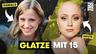 Wenn dir alle Haare ausfallen – Julies Leben mit Alopecia I TRU DOKU [upl. by Aihsenat503]