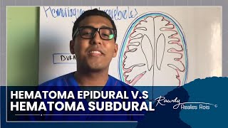 HEMATOMA EPIDURAL VS HEMATOMA SUBDURAL [upl. by Nairim]