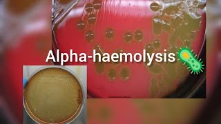 αhaemolysis streptococcus bacteria microbiology [upl. by Jochbed]