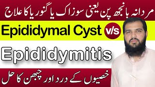 Epididymitis treatment in hindi  Epididymal cyst treatment  sozak Ka ilaj  Epididymitis [upl. by Aimaj]