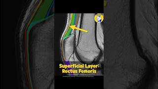 Fig 4B01 Anatomy of the Multilayered Quadriceps Tendon Part 1 [upl. by Kauslick254]