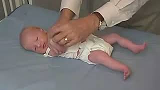 44  Tone Upper Extremity Tone  Newborn Abnormal  Infant Clinical ExaminationMRCP [upl. by Aztilay]