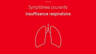 Quels sont les symptômes du Covid19 [upl. by Acilegna]