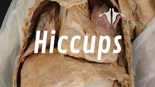 What Are Hiccups and Why Do We Get Them [upl. by Riggs]