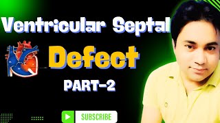 Ventricular Septal Defect VSD Explained  Causes Symptoms Diagnosis amp Treatment  Part2  DJMC [upl. by Hedges138]