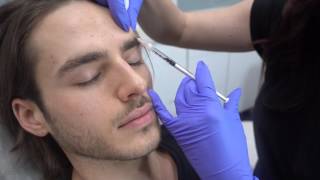 Preventative Glabella Dysport on Male Client [upl. by Einoj]