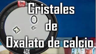 Cristales de oxalato de calcio normales y monohidratado Uroanalisis [upl. by Attiuqehs270]