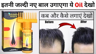 Indulekha Hair Oil Review  indulekha hair oil results  how to use indulekha hair oil [upl. by Niltiak]