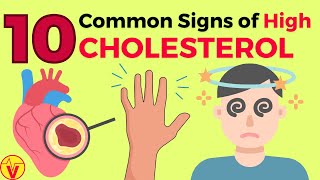 10 Common Signs of High CHOLESTEROL You SHOULD NOT Ignore  VisitJoy [upl. by Ilhsa754]