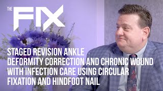 The FIX with Dr M Subik  Revision Ankle Deformity Correction w Circular Fixation amp Hindfoot Nail [upl. by Berkin]