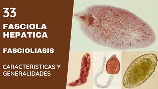 FASCIOLA HEPÁTICA 33  FASCIOLIASIS  TREMATODOS [upl. by Naahsar411]