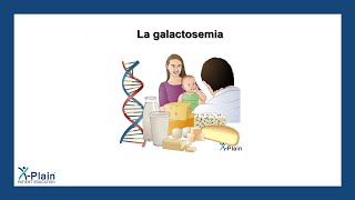 La galactosemia [upl. by Hallee]